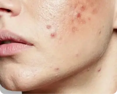 Dry/Sensitive Skin