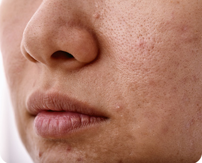 Textured Skin